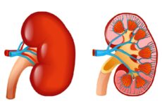 چگونه-میتوان-از-سنگ-کلیه-پیشگیری-نمود؟