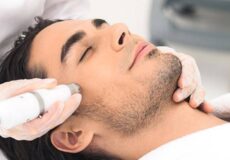 microdermabrasion-peeling