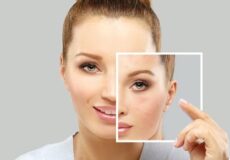 Skin-Rejuvenation