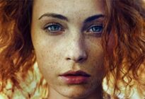 Freckles on face