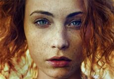 Freckles on face