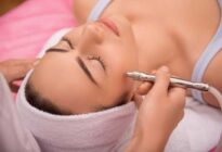 electrolysis-for-hair-removal
